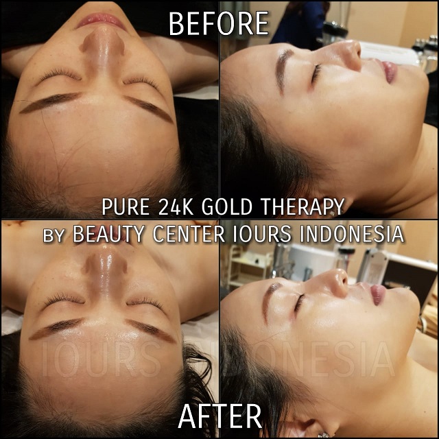 Beauty Treatment